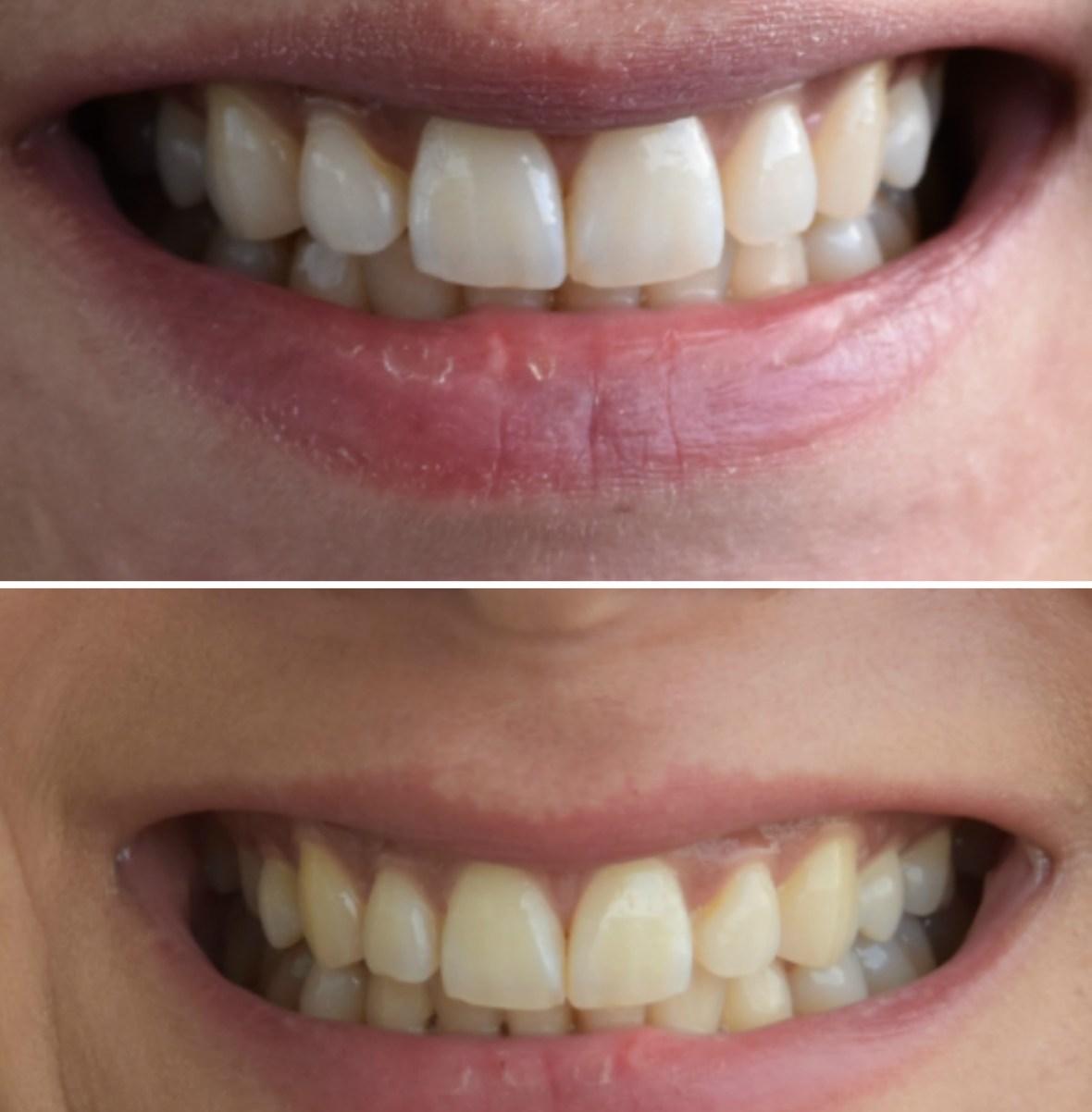 BeFunky Collageteeth2closer.jpg